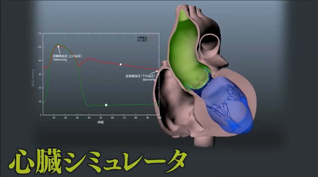 心臓シミュレータを活用した新たな医療機器開発に関して 株式会社ut Heart研究所 富士通株式会社 との三社間共同研究契約を締結 Doctokyo Web