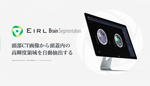 頭部CT画像から頭蓋内の高輝度領域を自動抽出するEIRL Brain Segmentation、販売を開始