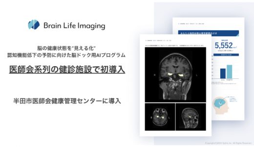 医師会系列の健診施設で初導入。認知機能低下の予防に向けた脳ドック用AIプログラム「Brain Life Imaging® 」半田市医師会健康管理センターで導入