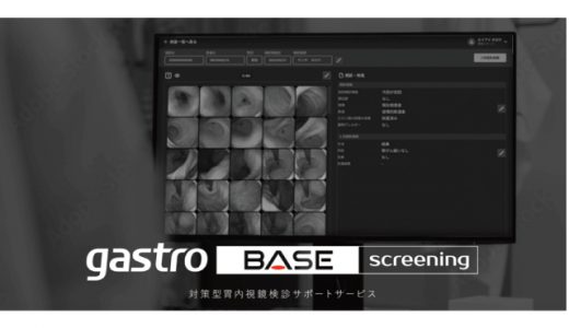 AIメディカルサービス、検診業務をクラウドでDX化する対策型胃内視鏡検診サポートサービス「gastroBASE screening」をリリース