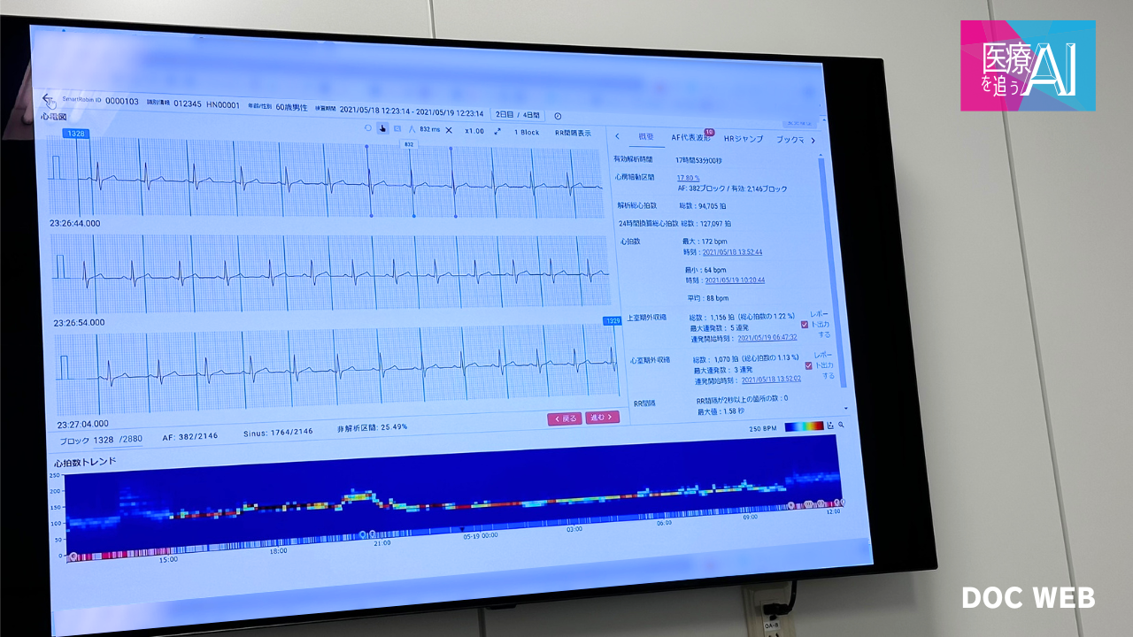 SmartRobinの画面の一例。解析結果が一目でわかる