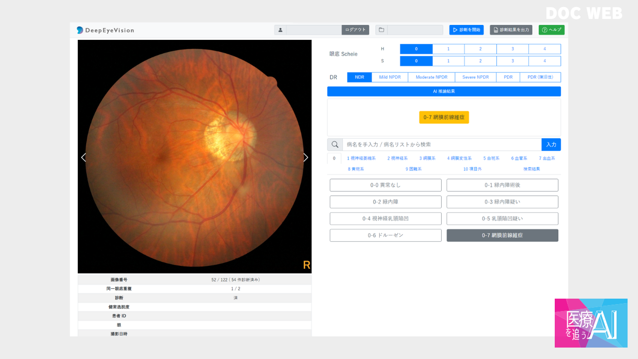 研究用医療AI システム。検索エンジンの入力補助のように、予測疾患を表示する。